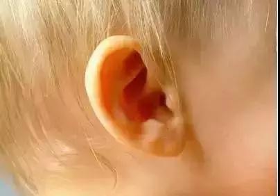 防治耳鸣耳聋重在细节,怎样预防耳聋耳鸣