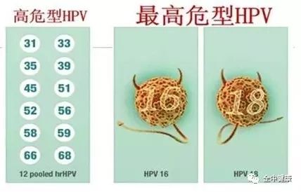 hpv感染发展到宫颈癌需要多长时间,hpv感染发展到宫颈癌要多长时间