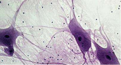 脐带血干细胞治疗内膜有效吗,脐带间充质干细胞能否应用临床