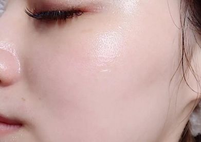 有了全世界3秒卖一瓶的“液体黄金“，干燥、长痘就与你无缘了！