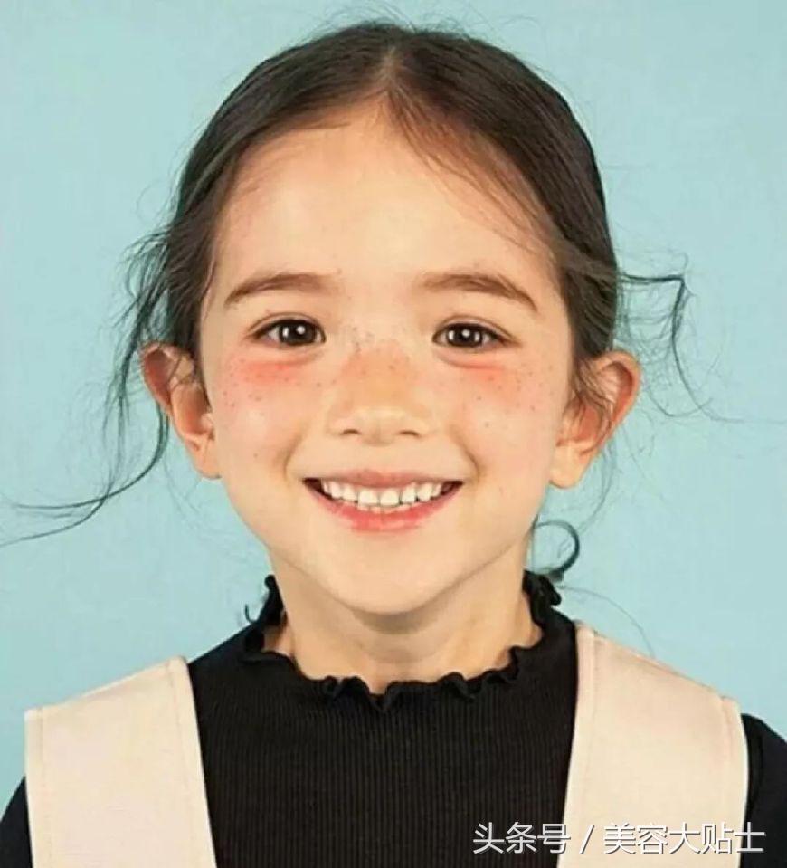 紫外线淡化斑小妙招,脸上有紫外线色斑怎么办