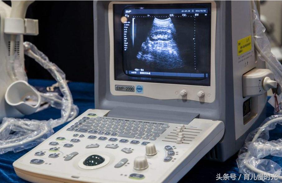 如何知道自己已经怀孕的？几乎都是这三步过来的