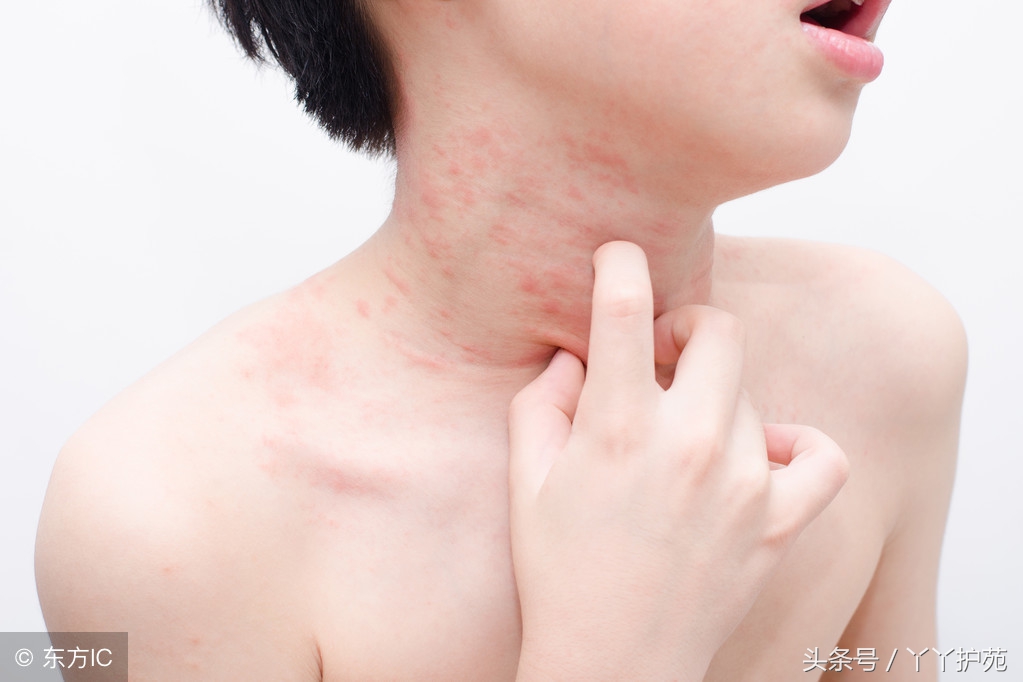 常见皮肤病的用药药膏,最常见的皮肤病和用药大全