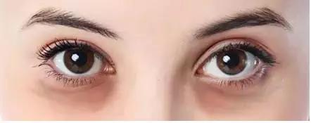 浪费钱的小红书爆款，劝你别买了！