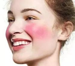 澳洲小红管万能膏,澳洲最好的万能膏