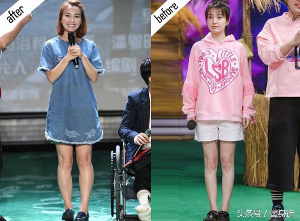 小腿外扩有得救!周冬雨、吴昕也曾腿歪,5种方法可改善
