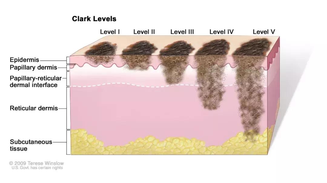 澳洲最新疫情澳洲入境最新通知,疫情下的澳洲真实情况