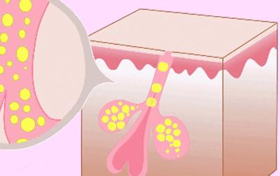 很火的洁面仪,超级好用的洁面仪