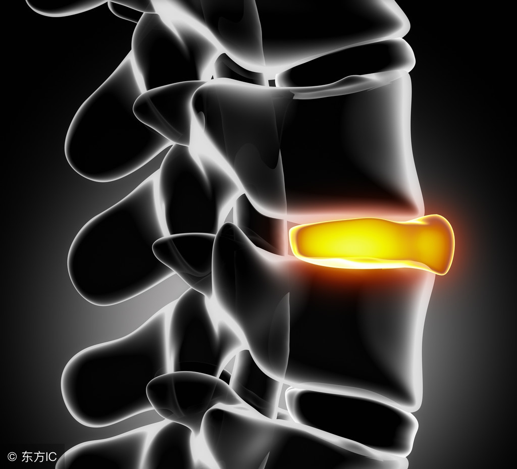 椎间盘突出腰痛的最佳治疗方法,如何缓解椎间盘突出腰腿痛