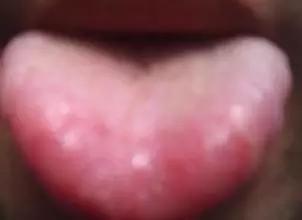 为什么三焦通了之后感觉身体好虚,三焦不通和湿寒有关系吗