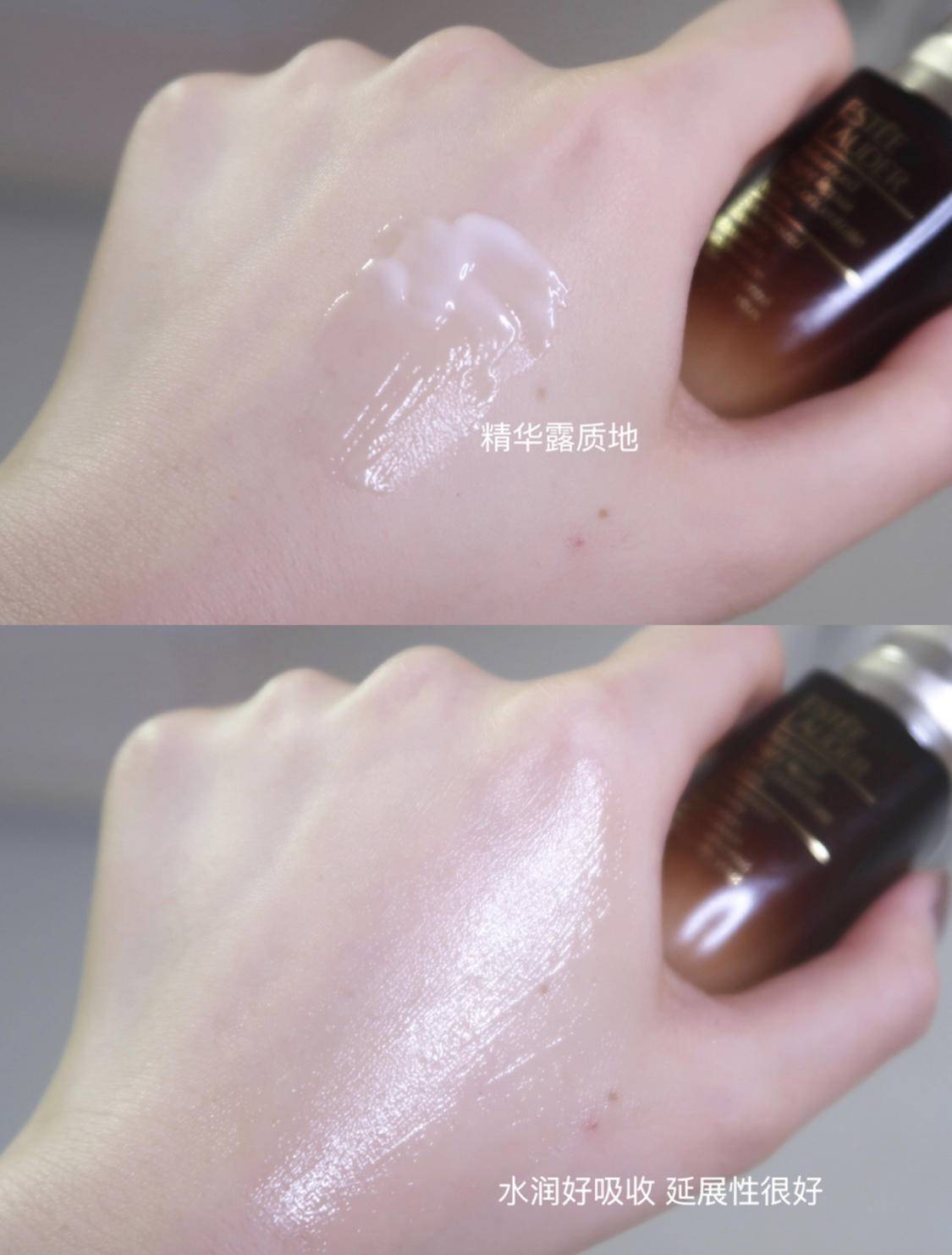 如何有效改善眼周水肿,眼水肿了怎么消肿