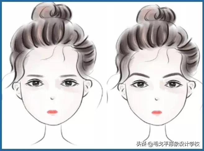 太阳穴凹陷颧骨突出怎么整容,颧骨外扩太阳穴凹陷整容