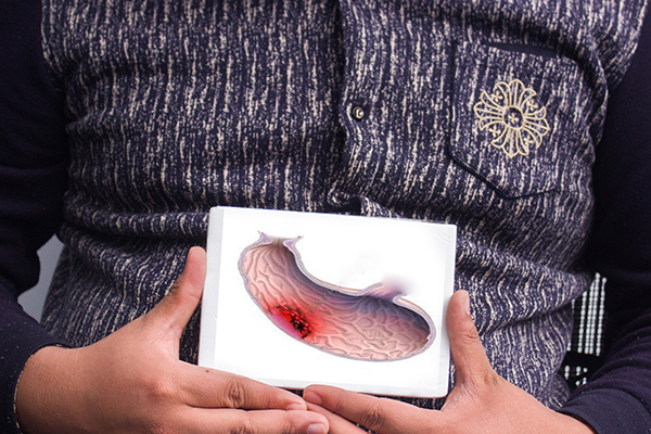 饭后食管反流是什么原因,饭后胃烧心反流是什么原因