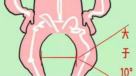 怎么判断宝宝腿型是否正常,宝宝腿型什么时候干预