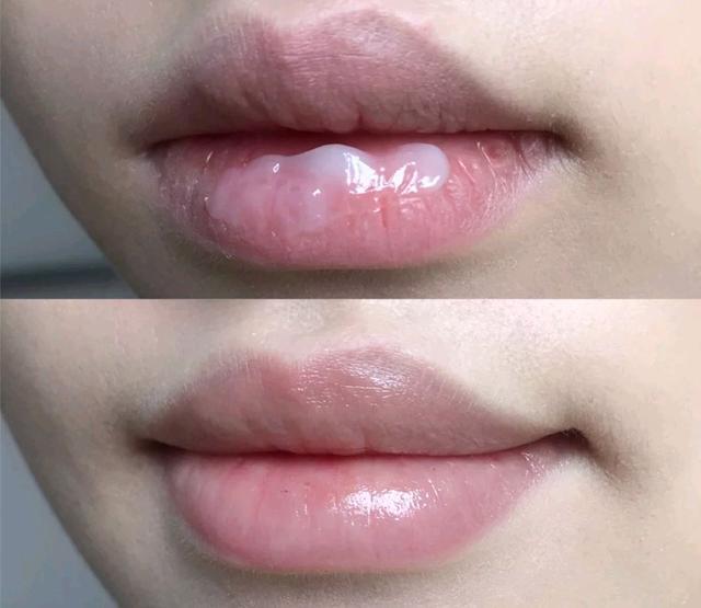 5款实力派润唇膏：placenta唇部精华小众零差评，曼秀雷敦最好用