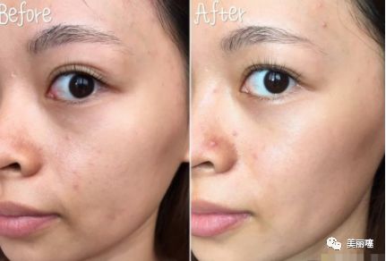 敷完面膜多余的精华怎么办,敷完面膜脸上的精华该不该洗