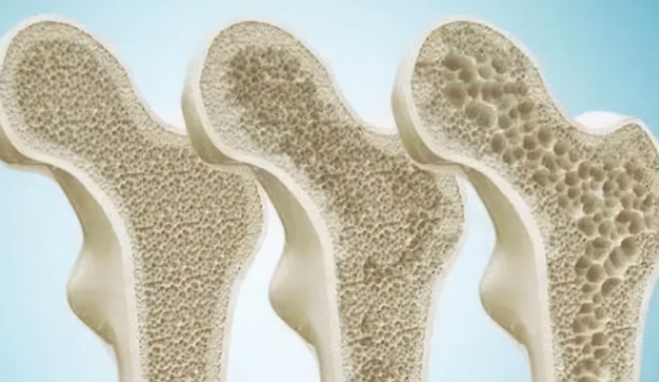 女性在49岁就绝经了?提前恭喜你:绝经后,四个问题不告而别