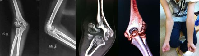 兵检体检前注意事项,当兵预检注意事项