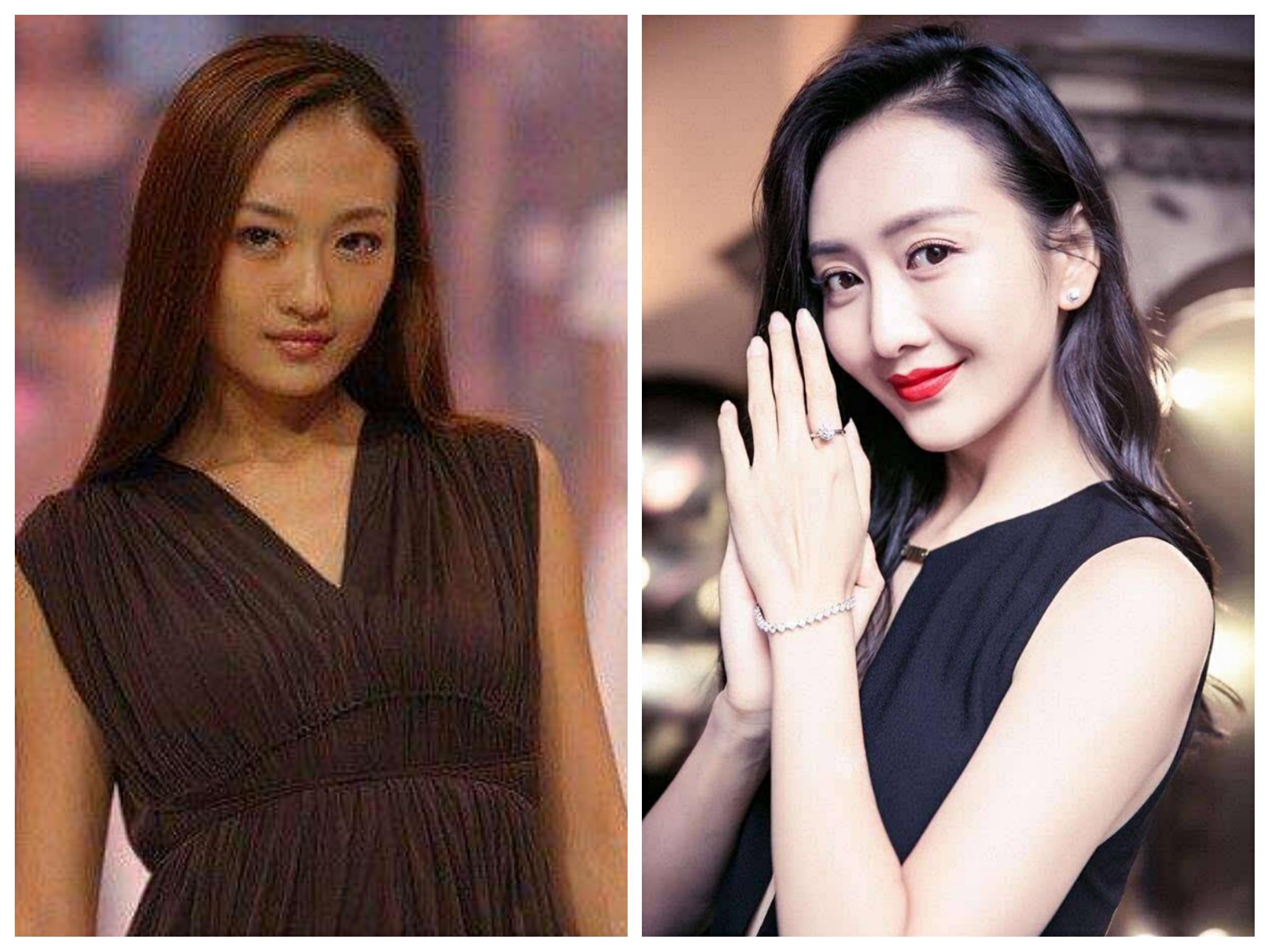 女人打美白针会变白吗,长期打美白针对身体有危害吗