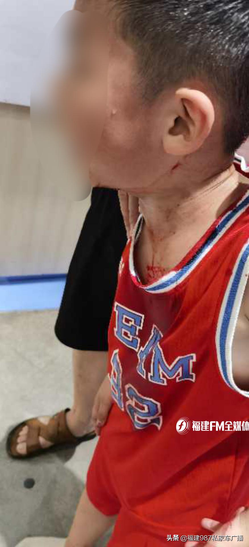 孩子在福州东泰禾游乐场撞到后脑勺，头破血流，索要营养费合理吗？