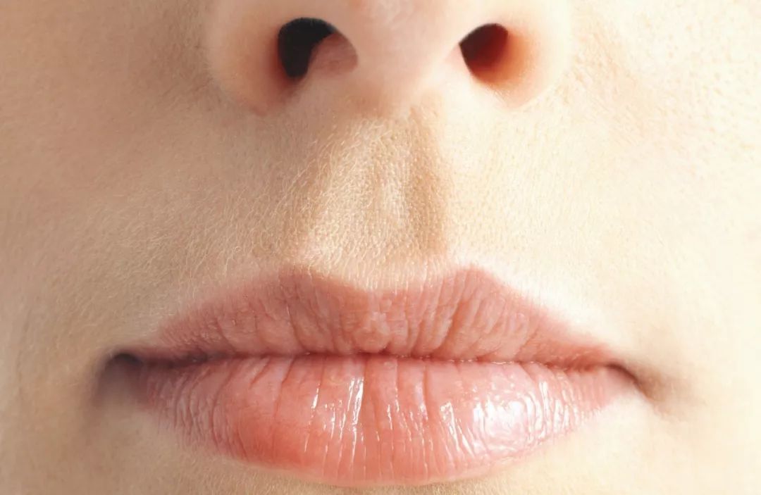 鼻孔外露一招解决,鼻孔有点外露怎么解决