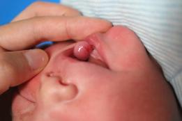 鐗欓緢涓婂皬鑲跨槫,鐗欓緢涓婄殑鑲跨槫