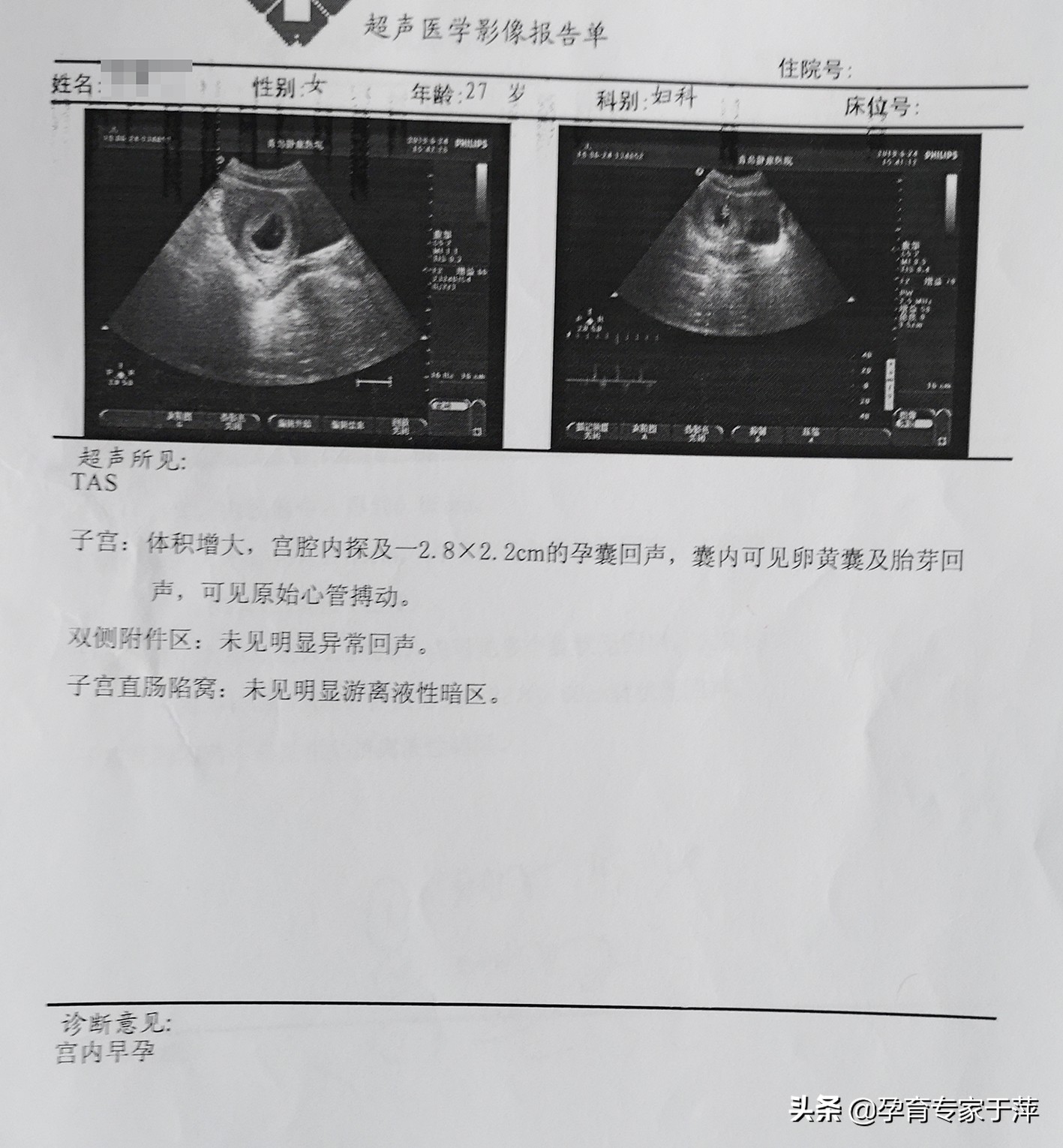 助孕专家于萍讲述,青岛专家于萍简介