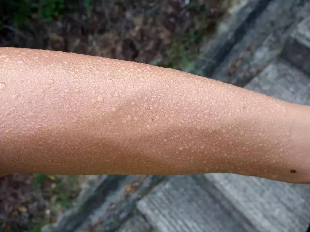 夏季小孩能剃光头光脚吗,孩子夏天到底能不能吃冰啊