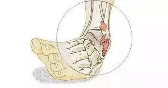 泗阳治疗脚崴的地方,泗阳哪家医院治疗脚扭伤