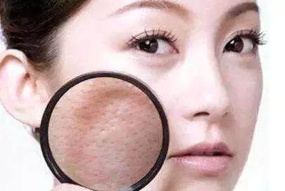 毛孔粗大收缩毛孔最有效方法实测,毛孔粗大收缩毛孔最有效的小妙招