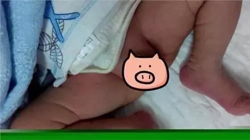 很多孕妈妈纠结怎么护理宝宝,孕妇怎么护理好宝宝皮肤