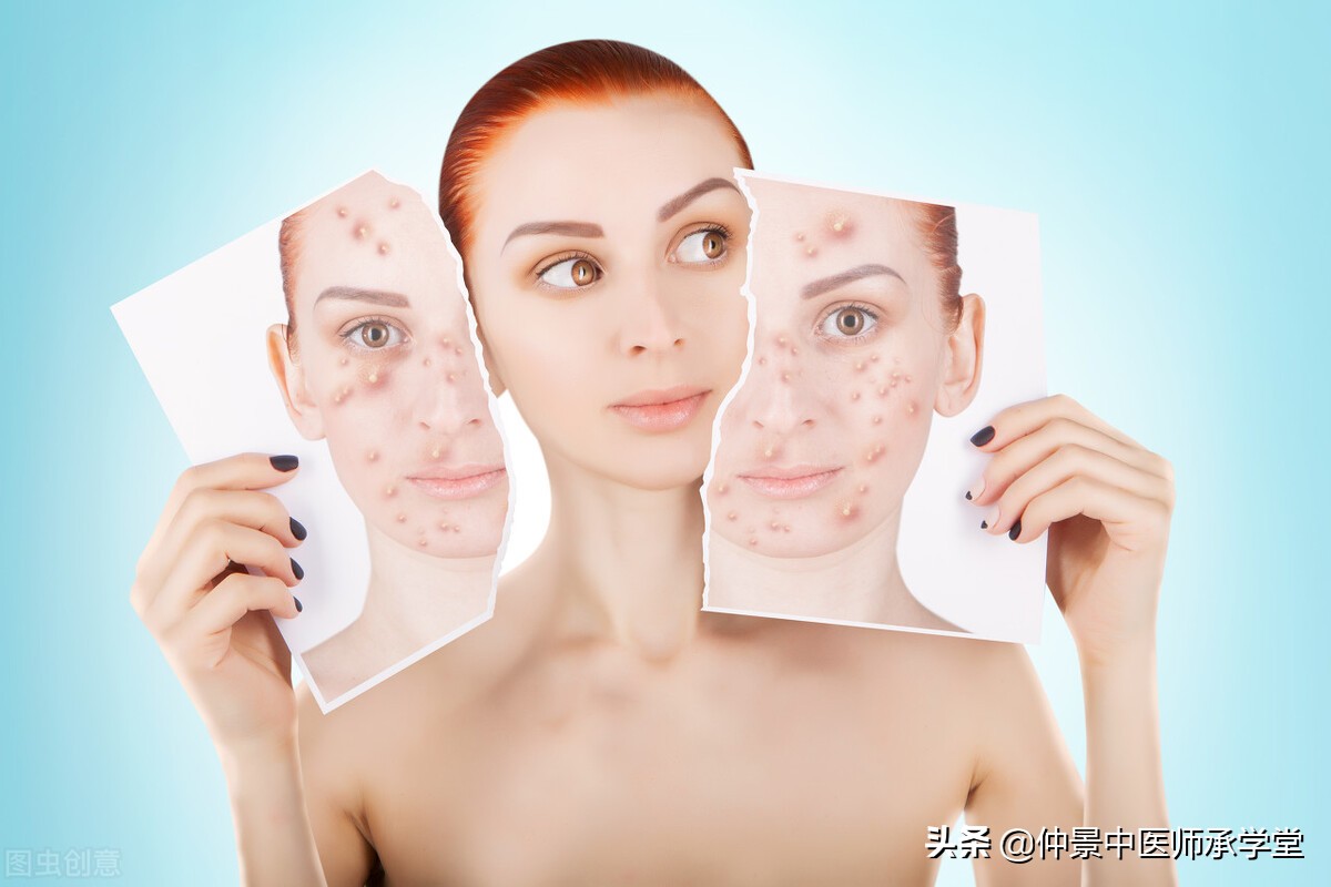 鼻孔生疮中医辨证论治,中医治疗口鼻生疮