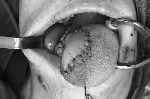 大叔被鱼刺扎伤,大叔被鱼刺伤