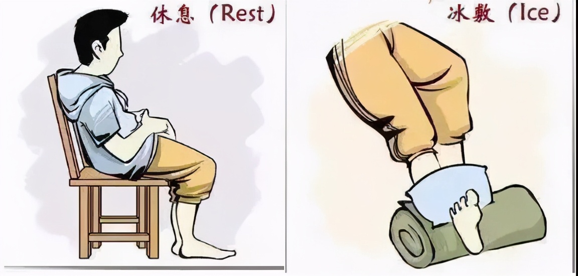 崴脚热敷和涂药,崴脚治疗要不要敷药