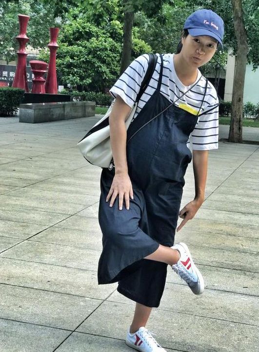 35周脚肿得像个猪蹄一样怎么缓解,孕晚期脚肿得像猪蹄怎么缓解