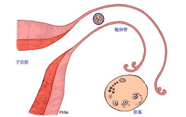 多囊卵巢综合征导致不孕能治好吗,协和医院内分泌科多囊卵巢