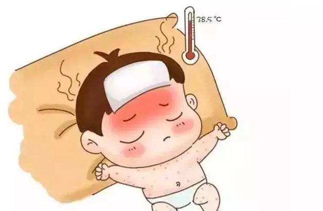 幼儿急疹的症状及相应的处理方法,幼儿急疹的症状及注意事项