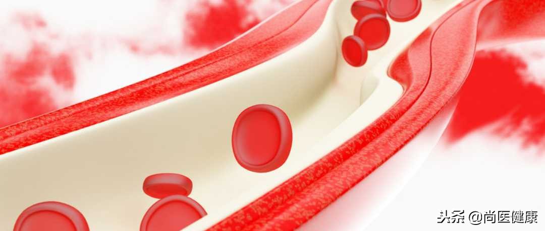 血液杂质较多且粘稠度高怎么办,血液粘稠吃什么能快速解决