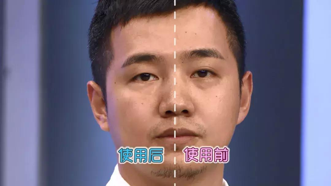 补水保湿淡化黑眼圈眼袋,黑眼袋黑眼圈用什么护肤品消除