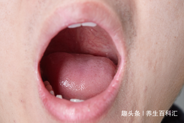 口臭是社交“尴尬癌”，教你简单几招，帮你自测口臭程度