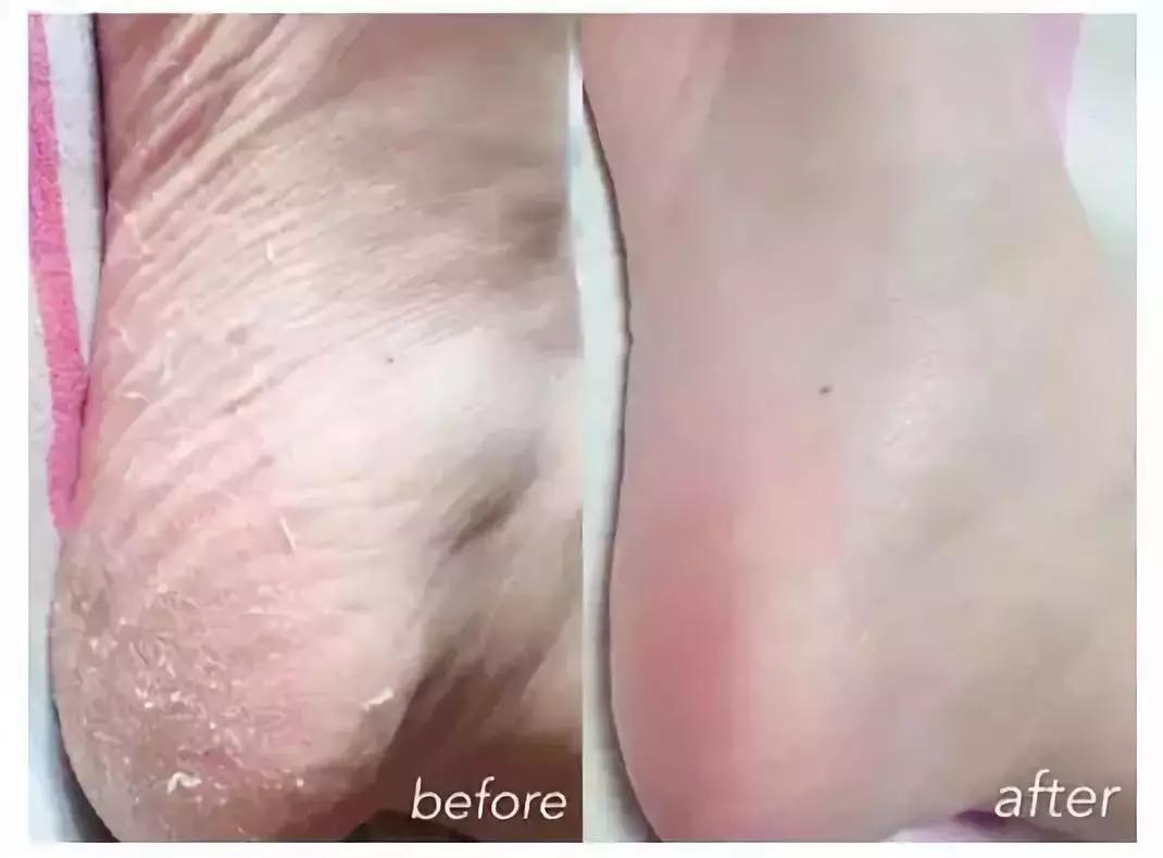 透气舒适不捂脚潮袜推荐,好穿又好搭吸汗防臭袜