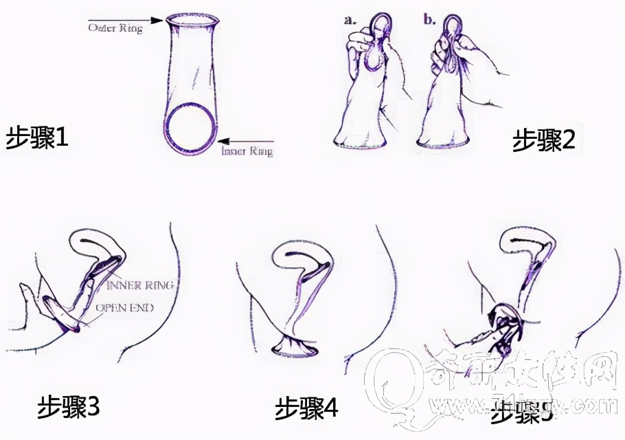 男女怎样避孕才不伤害身体,有效的避孕方法不伤身