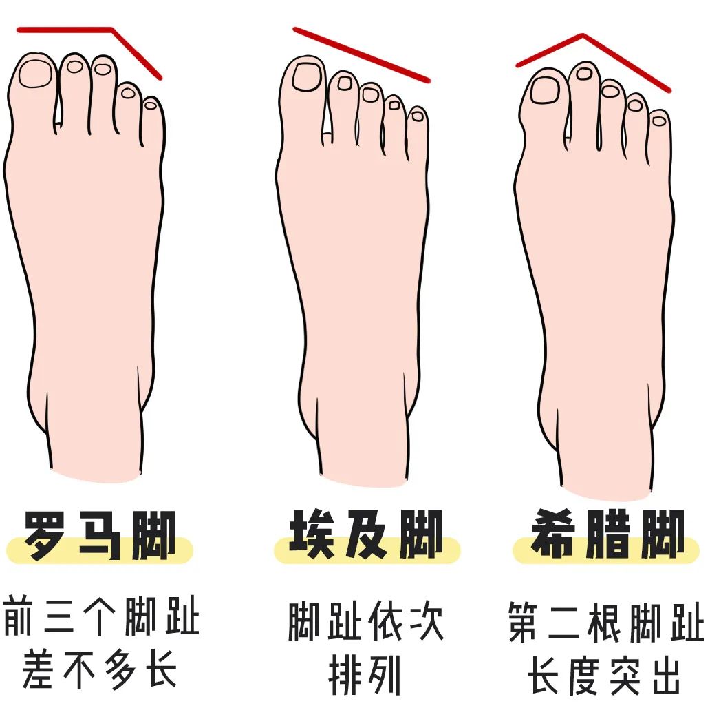 有胖胖的凉鞋,凉鞋穿什么款式好看