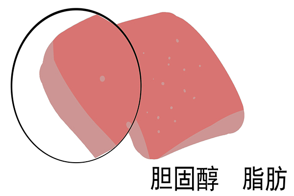 牛奶是补脑还是健脑,牛奶好喝又补钙但有5类人可别喝