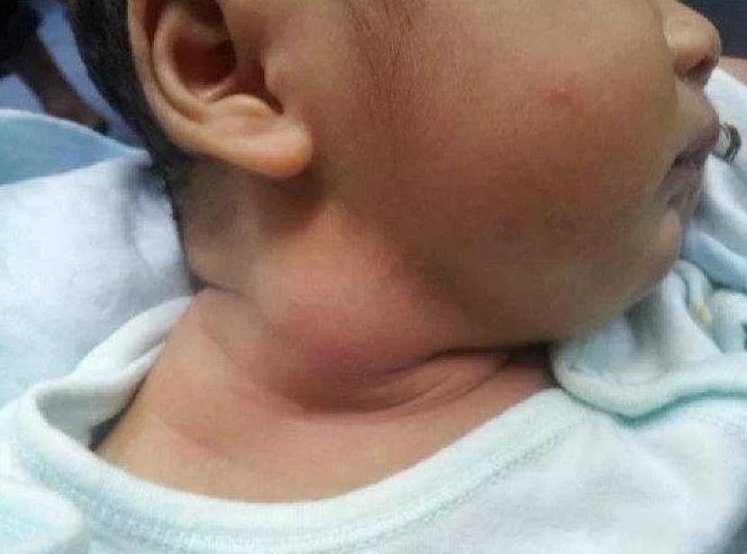 宝宝脖子轻微歪能治好么,宝宝脖子歪了是什么原因