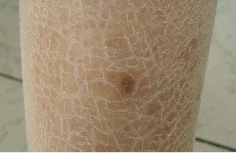 阿胶补哪里的血,吃阿胶红糖补血吗