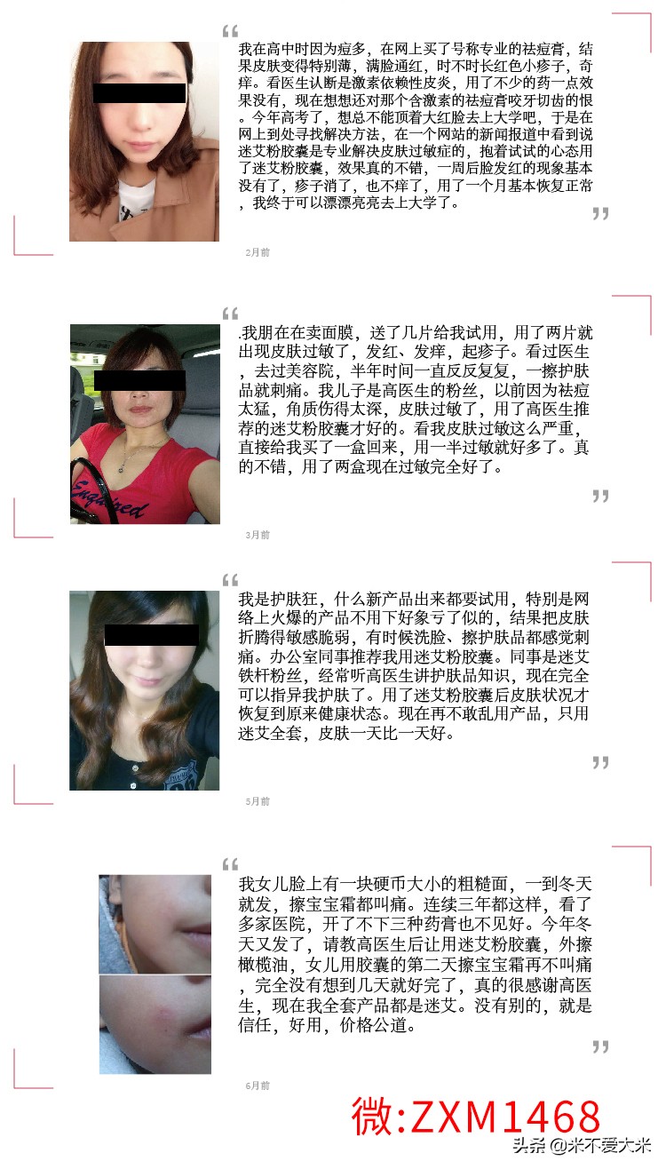 让我告诉你如何像范冰冰舒淇等女星那样治好自己的过敏肌肤