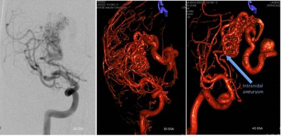 良性病可以做放疗吗？