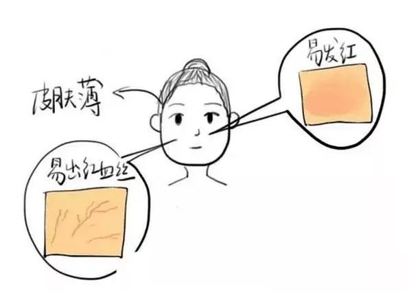 冬天面部角质层薄起皮泛红,换季敏感皮肤泛红脱皮怎么办
