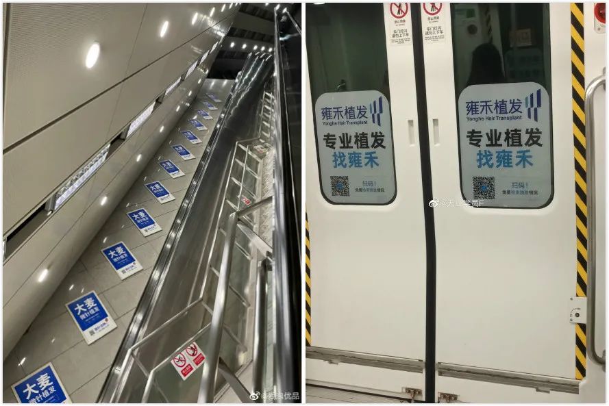 植发的市场前景,中国植发生意现状